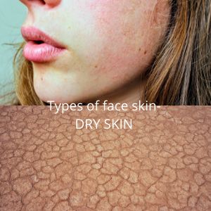 Types of face skin