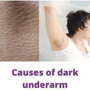 Causes of dark under arm